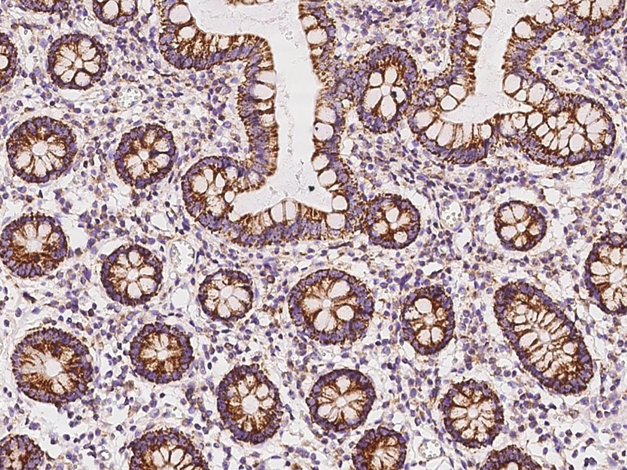 Polyclonal Rabbit anti-Human TBRG4 Antibody (IHC, IF)