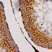 CCL27 Antibody (Internal)
