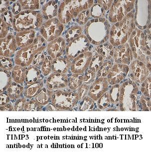Polyclonal Rabbit anti-Human TIMP3 Antibody (Internal, IHC)