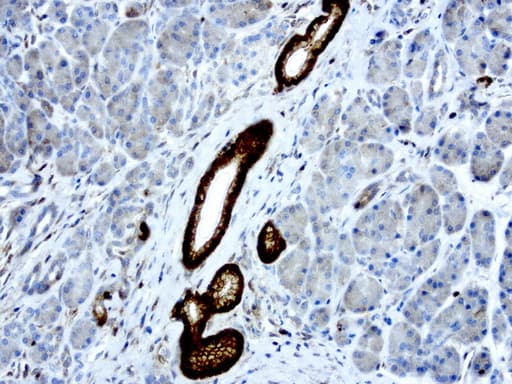 LGALS3 / Galectin 3 Antibody (clone UMAB189, Carrier-free)