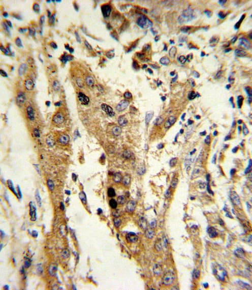 GSTM1 Antibody (aa184-211)