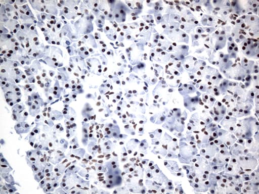 Monoclonal Mouse anti-Human GTF3C4 Antibody (clone OTI4A3, aa583-822, IHC, WB)