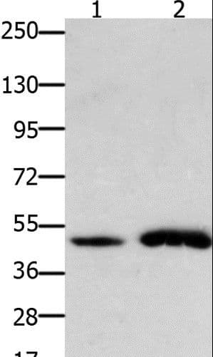 FOXL2 Antibody