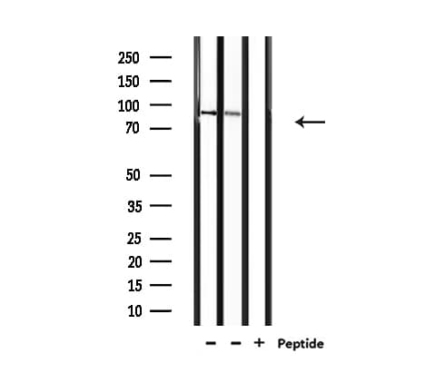 Polyclonal Rabbit anti-Human AKAP2 Antibody (IF, WB)