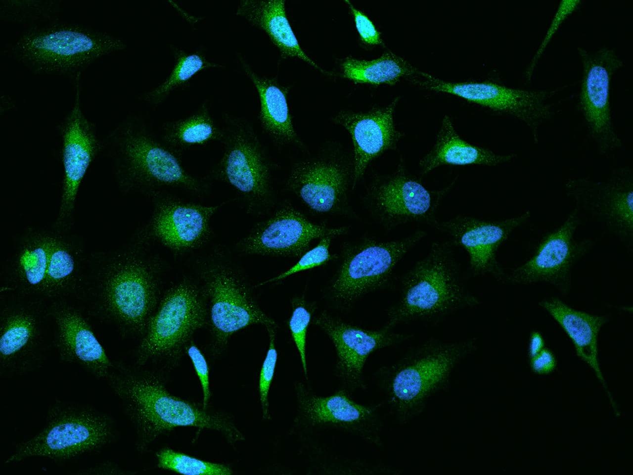 OS9 Antibody
