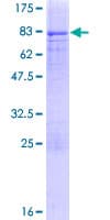 Human PAX3 Protein (Recombinant GST)