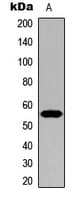 CYP21A2 Antibody (Internal)