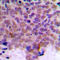 CLK1 / CLK Antibody (Internal)