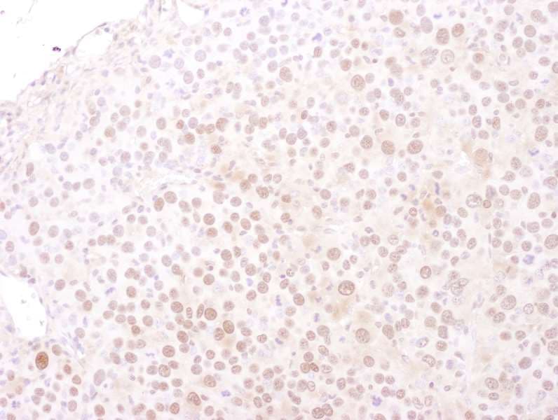 Polyclonal Goat anti-Human MCM4 Antibody (aa325-375, IHC, WB)