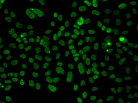 PLCXD2 Antibody