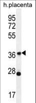 Polyclonal Rabbit anti-Human OR4L1 Antibody (aa276-304, WB)