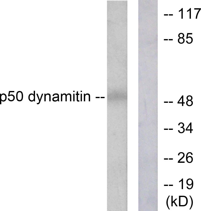 Dynactin 2 / Dynamitin Antibody (aa341-390)