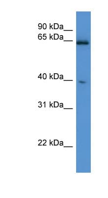 ASRGL1 Antibody (aa251-300)