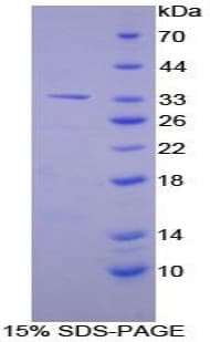 Mouse GPT / Alanine Transaminase Protein (Recombinant His-T7)