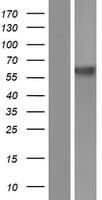 Human SLC11A2 / DMT1 Protein (Over-Expression Lysate Myc-DDK (Flag))