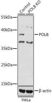 POLB / DNA Polymerase Beta Antibody