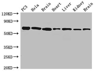 IHC-plus™ Polyclonal Rabbit anti-Human GPI Antibody (aa2-554, IHC, IF, WB)