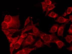 LRP1 / CD91 Antibody