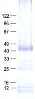 Human PDIK1L Protein (Recombinant His, N-Terminal)