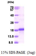 Human BATF Protein (Recombinant His)