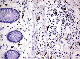 F13A1 / Factor XIIIa Antibody (clone OTI3F6)