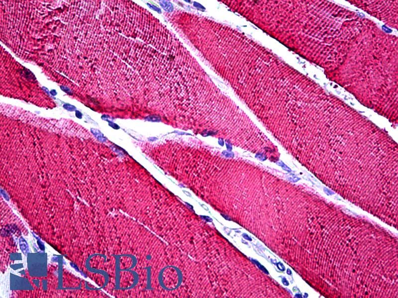 IHC-plus™ TNNC1 / Cardiac Troponin C Antibody