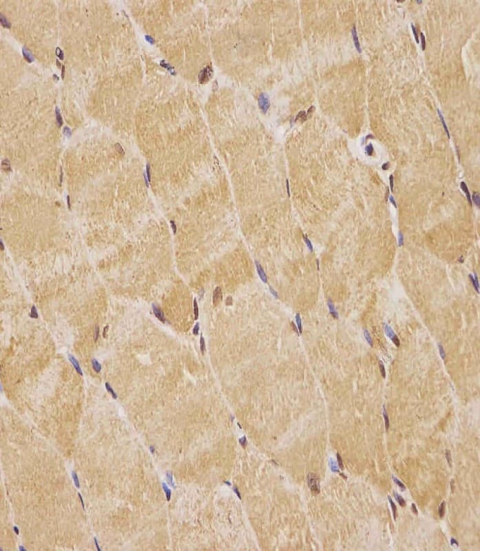 TK1 / TK / Thymidine Kinase Antibody (Internal)