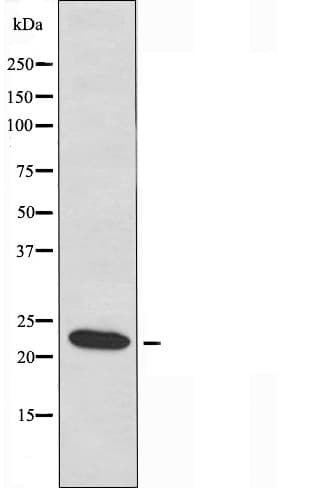 SCN2B Antibody
