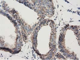 Monoclonal Mouse anti-Human AK3 / Adenylate Kinase 3 Antibody (clone OTI3G1, IHC, IF, WB)