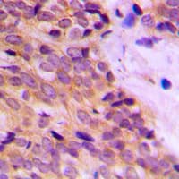 KRT14 / CK14 / Cytokeratin 14 Antibody (N-Terminus)