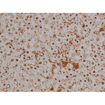 MAPT / Tau Antibody (phospho-Ser396)