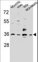 RIC3 Antibody (aa313-341)