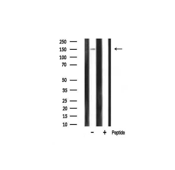 Polyclonal Rabbit anti-Human PLCG1 Antibody (IHC, IF, WB)