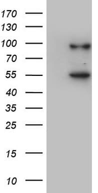 VWF / Von Willebrand Factor Antibody (aa764-1263, clone OTI1D4)
