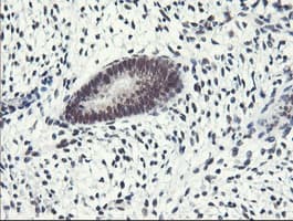 ERCC1 Antibody (clone 2.00E+12)