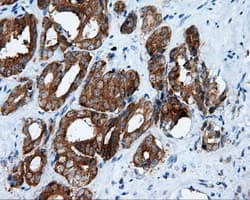 Monoclonal Mouse anti-Human RIP1 / RALBP1 Antibody (clone OTI1E2, IHC, IF, WB)