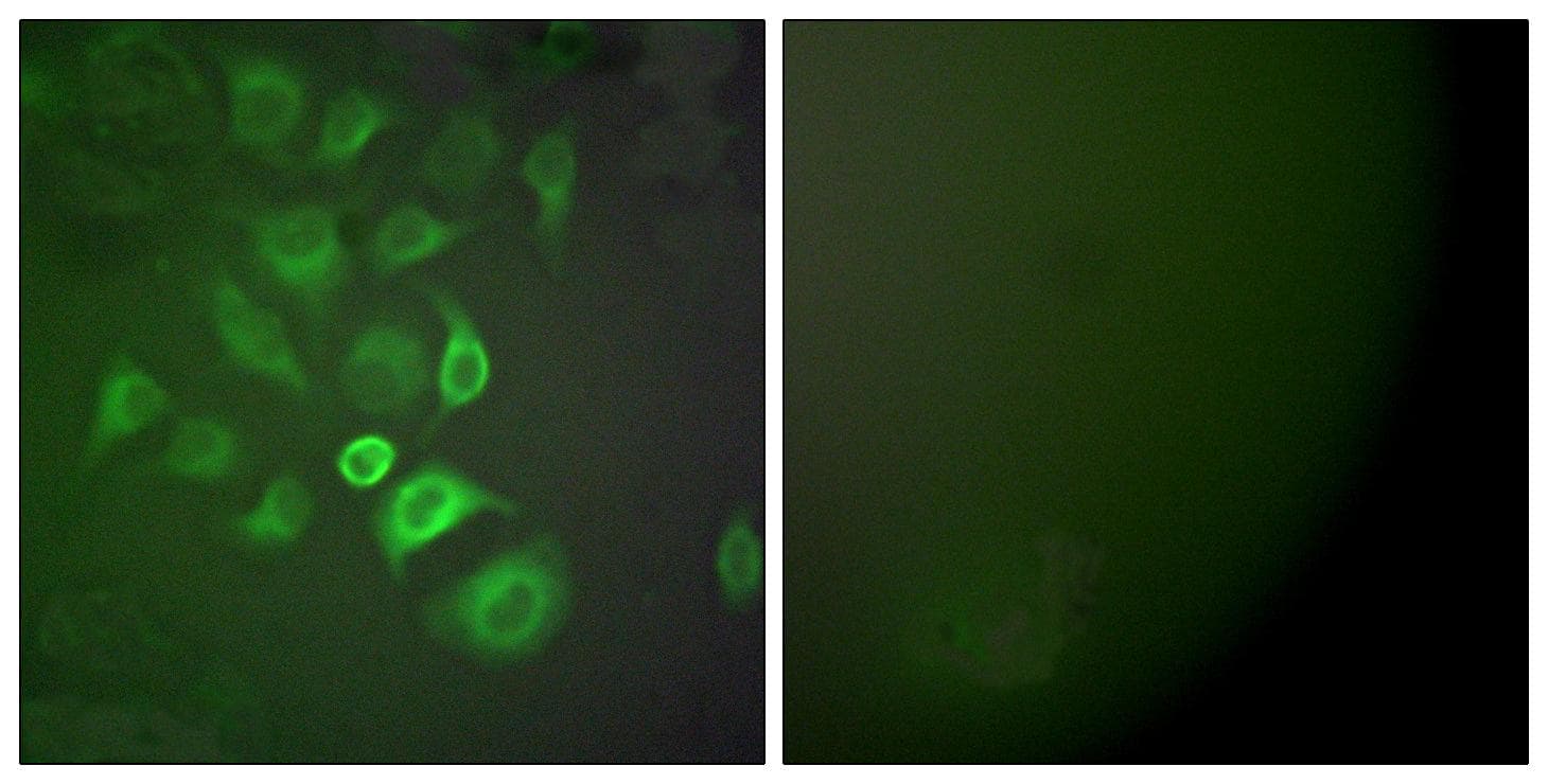 Polyclonal Rabbit anti-Human S100 Protein Antibody (IHC, IF, WB)