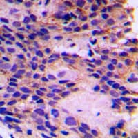 Polyclonal Rabbit anti-Human PEX7 Antibody (Internal, IHC, WB)