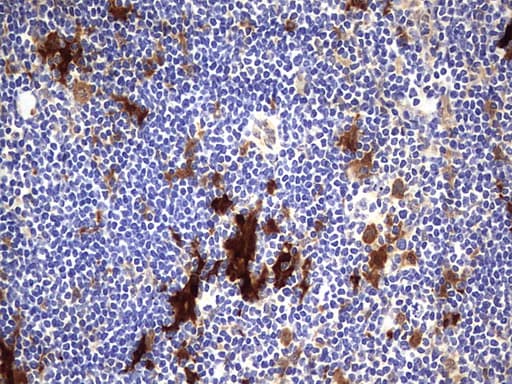 LGALS3 / Galectin 3 Antibody (clone OTI1C7)