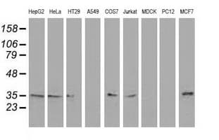 RTFDC1 Antibody (clone OTI3A5)