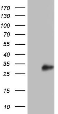 Adiponectin Antibody (aa19-244, clone OTI1E7)