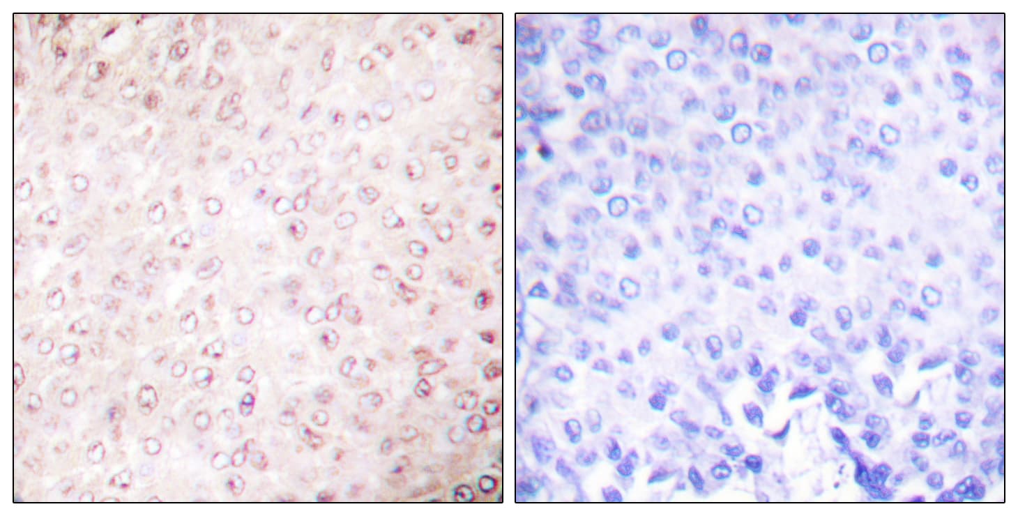 KAT2B / PCAF Antibody (aa783-832)