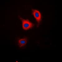 CTNND1 / p120 Catenin Antibody (phospho-Tyr228)