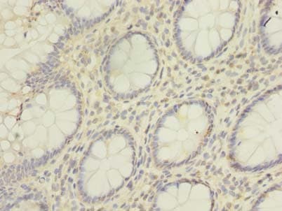 HNRNPL / hnRNP L Antibody