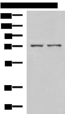 ZAP70 Antibody