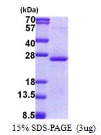 Human ORM2 / Orosomucoid 2 Protein (Recombinant His)