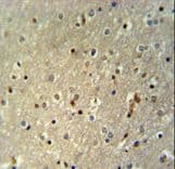 Polyclonal Rabbit anti-Human TTC26 Antibody (aa467-496, IHC, WB)