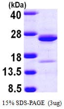 Human NCALD / Neurocalcin Delta Protein (Recombinant His)