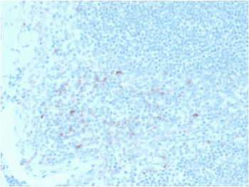 IL2RA / CD25 Antibody (clone IL2RA/2395)