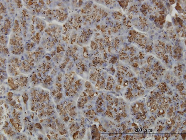CELA3A / ELA3 Antibody (clone 3G4)